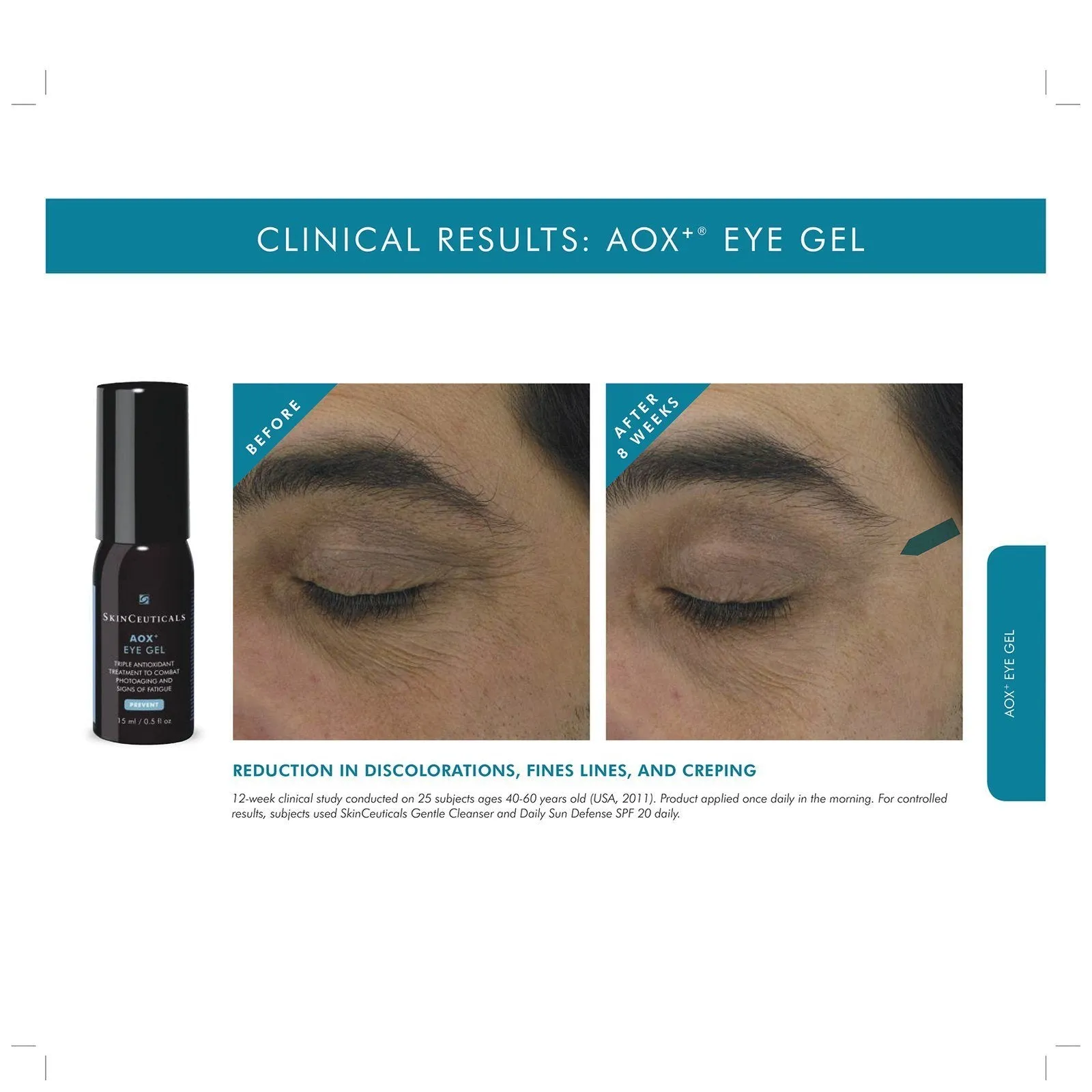 SkinCeuticals | AOX+ Eye Gel 15ml